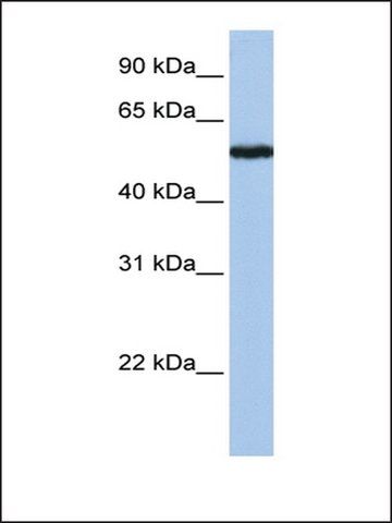 Anti-FLJ90709 antibody produced in rabbit