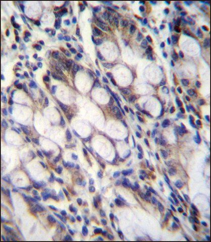 ANTI-FNDC7 (C-TERM) antibody produced in rabbit