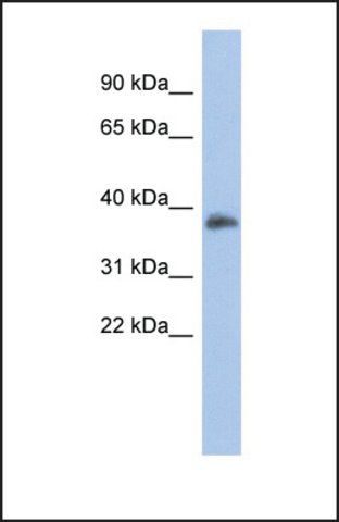 Anti-FOXB1 antibody produced in rabbit