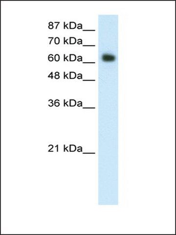 Anti-FOXG1B (AB2) antibody produced in rabbit