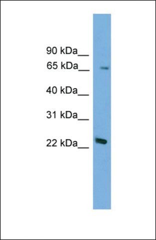 Anti-FOXN2, (N-terminal) antibody produced in rabbit