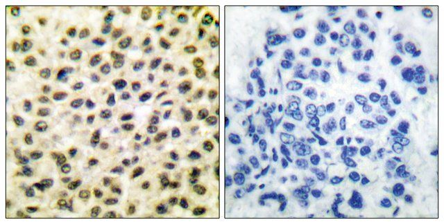 Anti-FOS antibody produced in rabbit