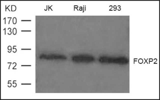 Anti-FOXP2 antibody produced in rabbit