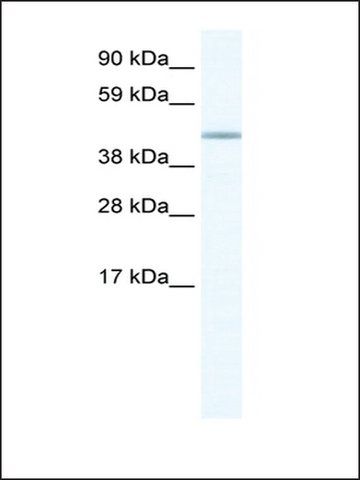 Anti-FOXD1 (AB2) antibody produced in rabbit