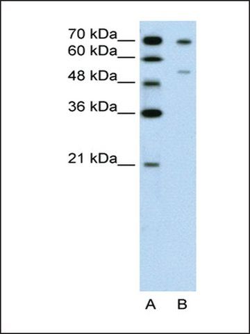 Anti-FOXB2 antibody produced in rabbit