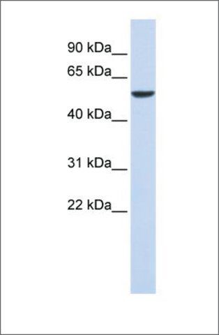 Anti-FOXD4 antibody produced in rabbit