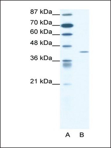 Anti-FOXL2 antibody produced in rabbit