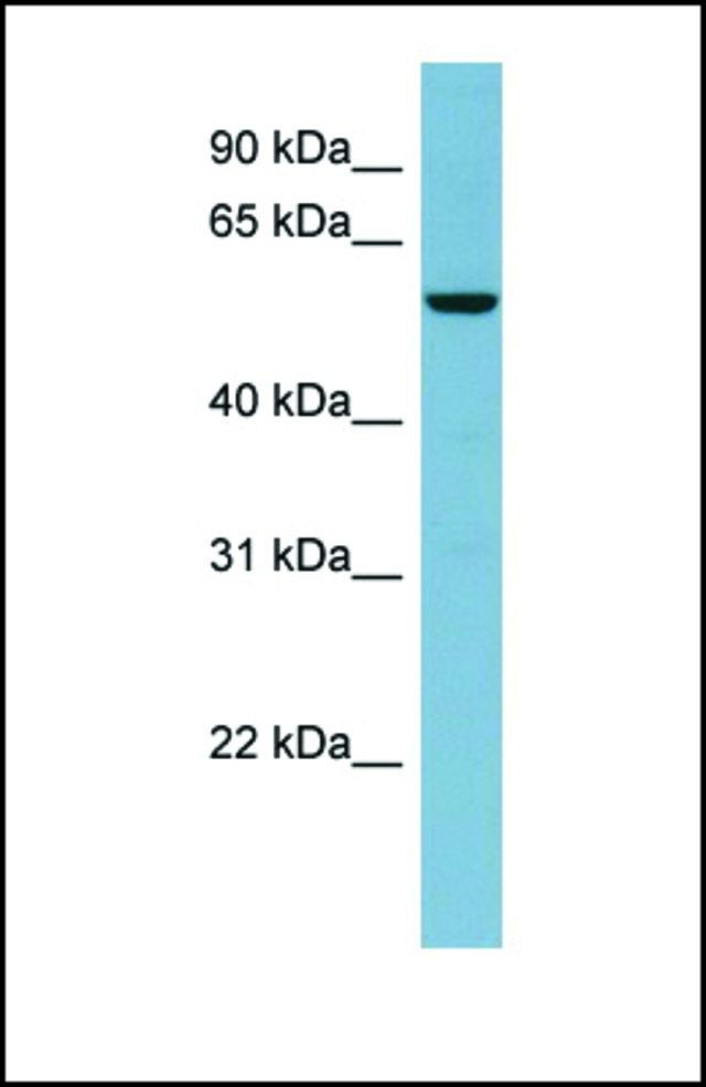 Anti-FLJ20674, (N-terminal) antibody produced in rabbit