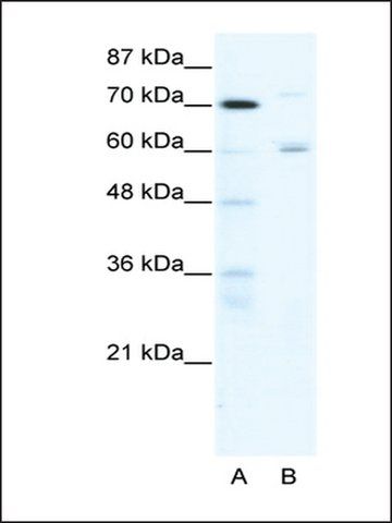 Anti-FOXJ2 (AB1) antibody produced in rabbit