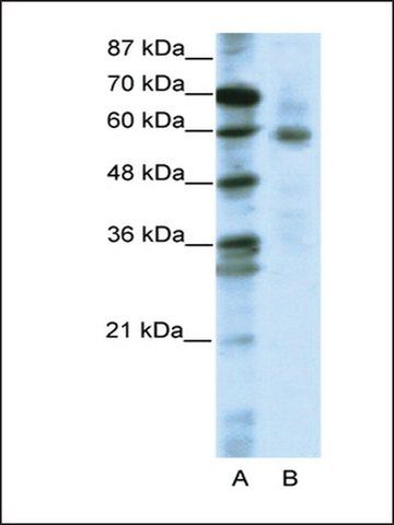 Anti-FOXO1A antibody produced in rabbit