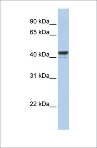 Anti-FOXJ1 antibody produced in rabbit