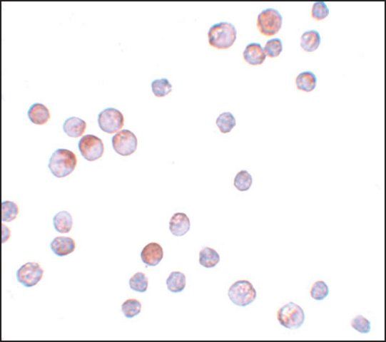 Anti-FOXO4 antibody produced in rabbit