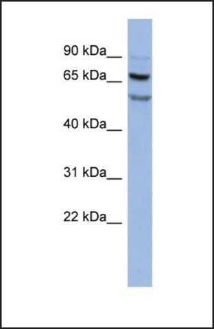 Anti-FOXRED1, (N-terminal) antibody produced in rabbit