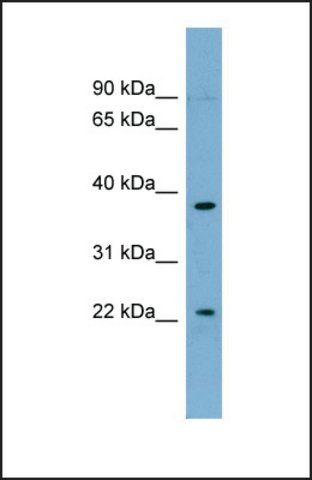 Anti-FOXN4 antibody produced in rabbit