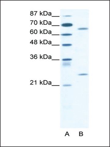 Anti-FOXK2 (ab2) antibody produced in rabbit