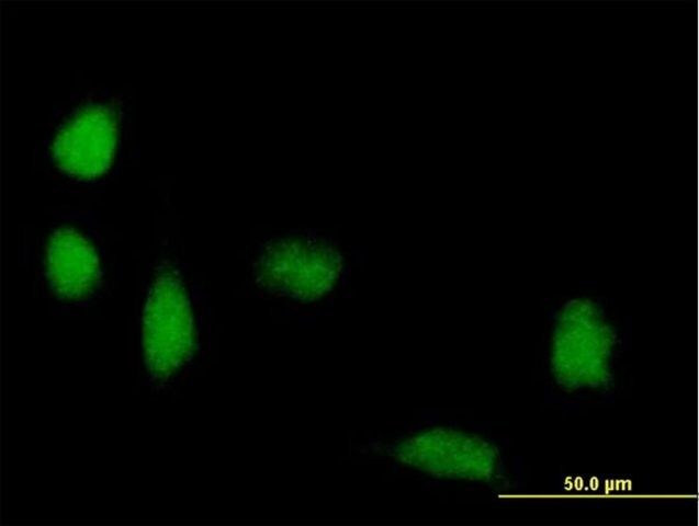 Anti-FOXP3 antibody produced in mouse