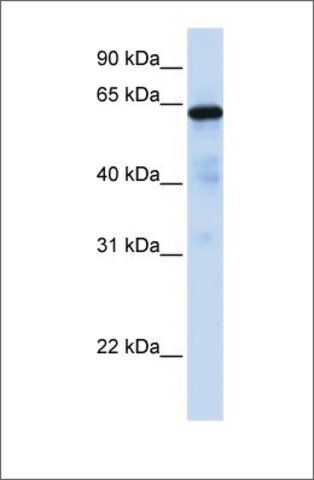 Anti-FOXN4 antibody produced in rabbit