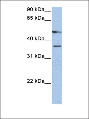 Anti-FOXD4 antibody produced in rabbit