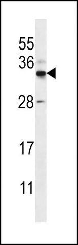 ANTI-FOXI2 (CENTER) antibody produced in rabbit