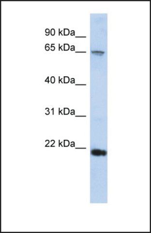 Anti-FSBP, (C-terminal) antibody produced in rabbit