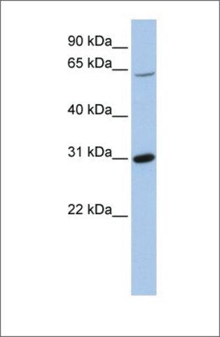 Anti-FRK antibody produced in rabbit