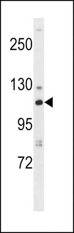 ANTI-FRUCTOSE 6 PHOSPHATE KINASE(N-TERMINAL) antibody produced in rabbit