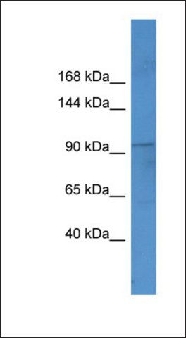 Anti-FTSJ3 antibody produced in rabbit