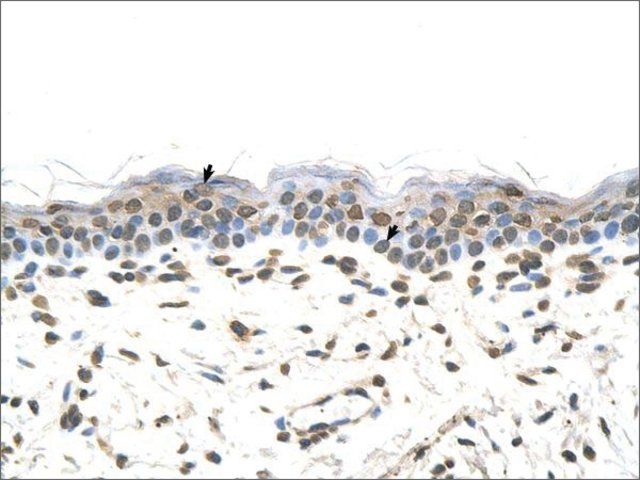 Anti-FTCD antibody produced in rabbit