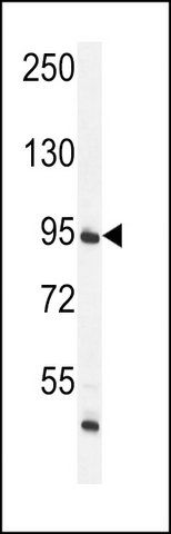 ANTI-FTSJ3 (CENTER) antibody produced in rabbit