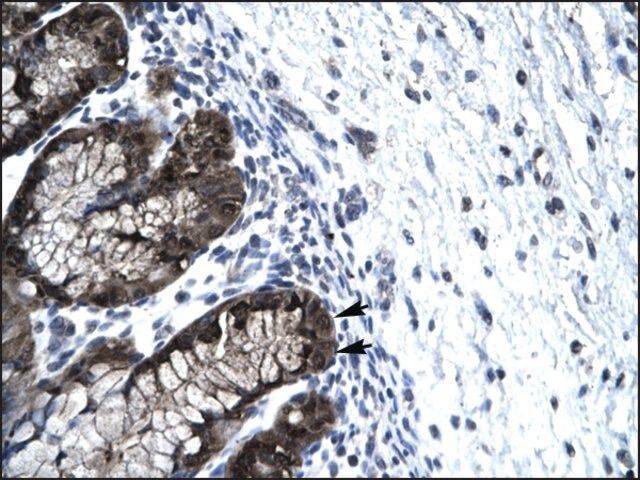 Anti-FOXJ2 antibody produced in rabbit