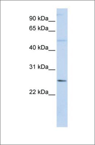 Anti-FTHL17 antibody produced in rabbit