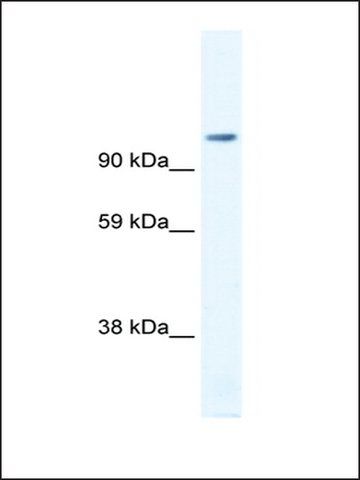 Anti-FOXP4 (AB2) antibody produced in rabbit