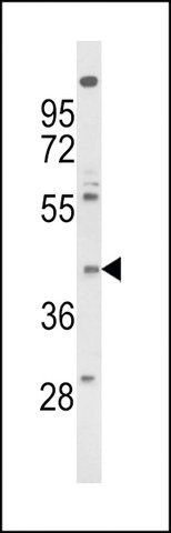 ANTI-FPRL2 (CENTER) antibody produced in rabbit