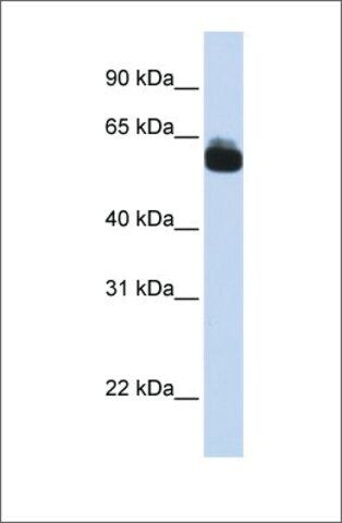 Anti-FZD9 antibody produced in rabbit