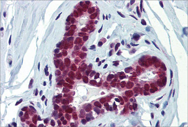 Anti-FUBP3 antibody produced in rabbit