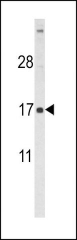 ANTI-FSHB (CENTER T70) antibody produced in rabbit