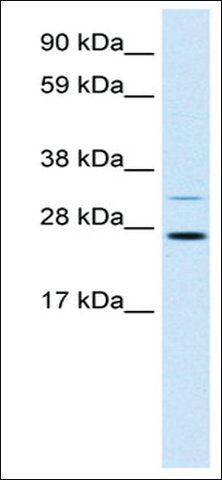 Anti-FSBP antibody produced in rabbit