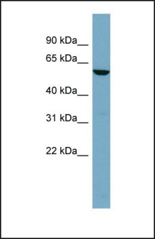 Anti-FUCA1 antibody produced in rabbit