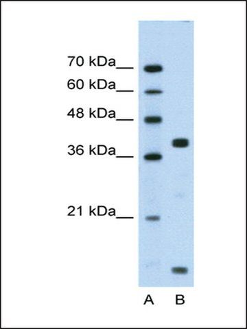 Anti-FXYD5 (AB2) antibody produced in rabbit