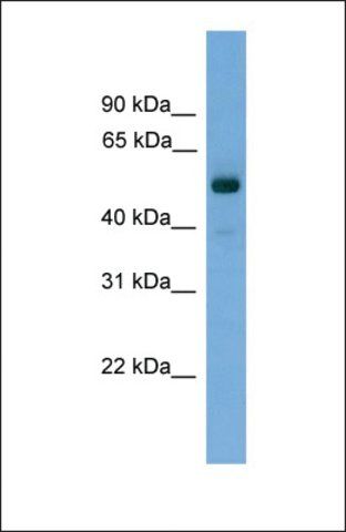 Anti-FSCN3 antibody produced in rabbit