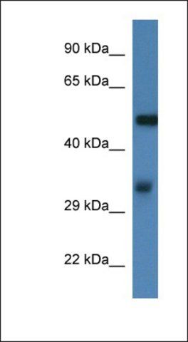 Anti-FSCN1 antibody produced in rabbit