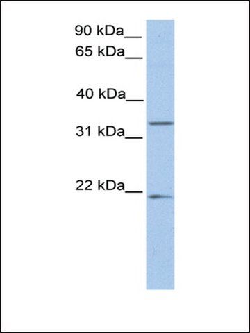 Anti-FUT6 antibody produced in rabbit