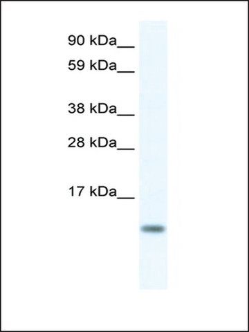 Anti-FXYD5 (AB1) antibody produced in rabbit