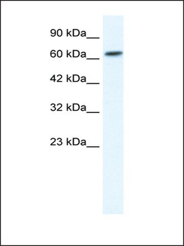 Anti-GABRB2 (AB2) antibody produced in rabbit