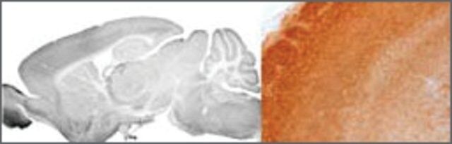 Anti-GABRA3 (AB2) antibody produced in rabbit