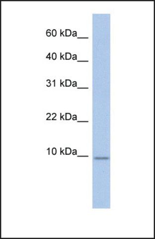 Anti-FXYD7, (N-terminal) antibody produced in rabbit