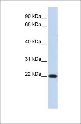 Anti-FXYD5 antibody produced in rabbit