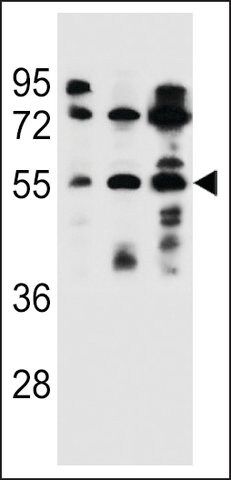 ANTI-FUT6(N-TERMINAL) antibody produced in rabbit