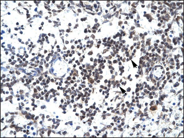 Anti-GABPB2 antibody produced in rabbit