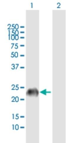 Anti-GAGE7 antibody produced in mouse